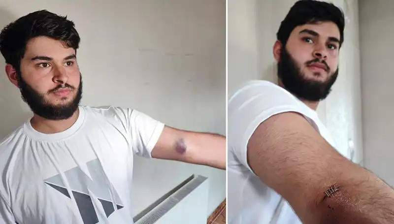 Bahçeye Kaçan Top, Mahallede Konuşulacak Olay Yaratıyor!