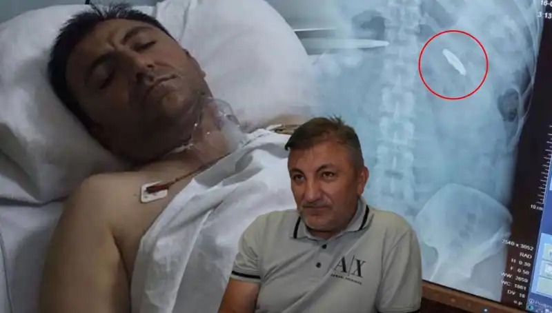 15 Temmuz’un Karanlık Yüzü: Kurşunla Yaralananların Unutulmaz Hikayeleri
